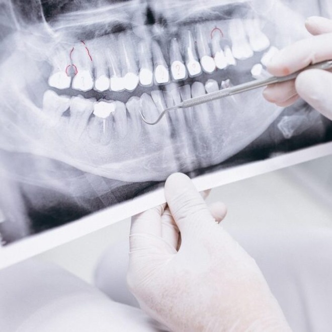 la importancia diagnostico dental correcto top (1)